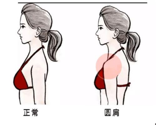 圆肩怎么矫正视频,跟随视频轻松恢复挺拔身姿